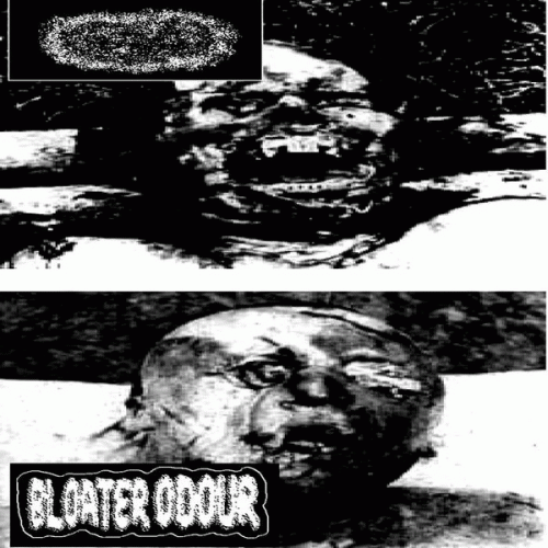 Hydroencephalocystocele : Hydroencephalocystocele - Bloater Odour Hydroencephalocystocele : Hydroencephalocystocele - Bloater Odour